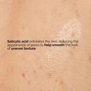 The Ordinary Salicylic Acid 0.5% Body Serum (100 ml) — view 11