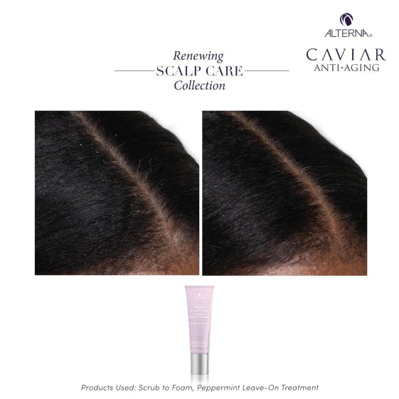Alterna Renewing Scalp Care Peppermint Leave-On Treatment 74 ml — view 5