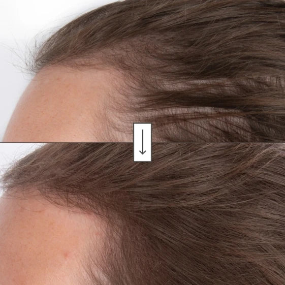 Briogeo Destined for Density MegaStrength+ Caffeine and Biotin Peptide Serum 45ml (45 ml) — view 3