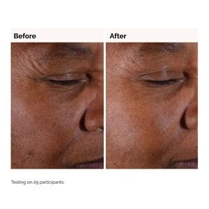 The Ordinary Glycolic Acid 7% Exfoliating Toner 100ml — view 5